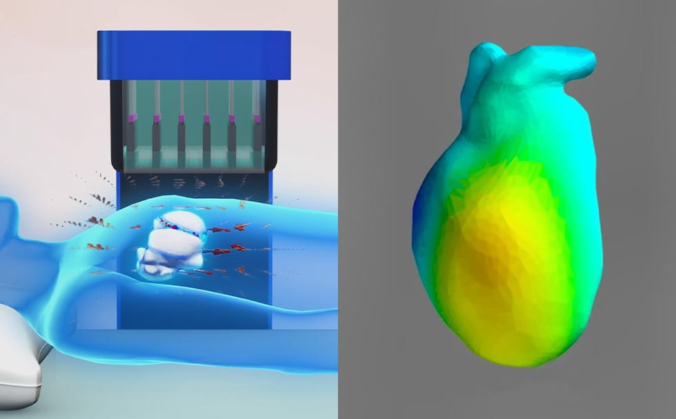 Medical device prototypes and 3D magnetocardiographic data
